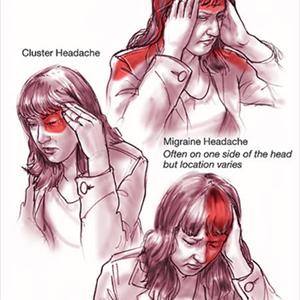 Cooling Headache Pads - Identify Migraine Symptoms For Treatment And Relief