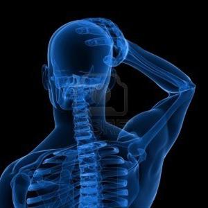 Severe Headache And Nausea - Cervicogenic Headache
